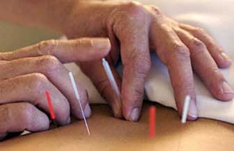 Silvana Both - Foto 1